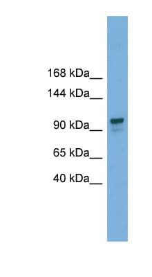 Polyclonal Rabbit anti-Human GANAB / Alpha Glucosidase II Antibody (C-Terminus, WB)