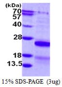 Human CSRP2 Protein (Recombinant His)