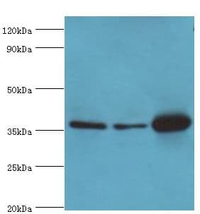 Polyclonal Rabbit anti-Human MDH1 Antibody (aa1-334, IHC, WB)