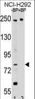 APPL2 Antibody (aa124-152)