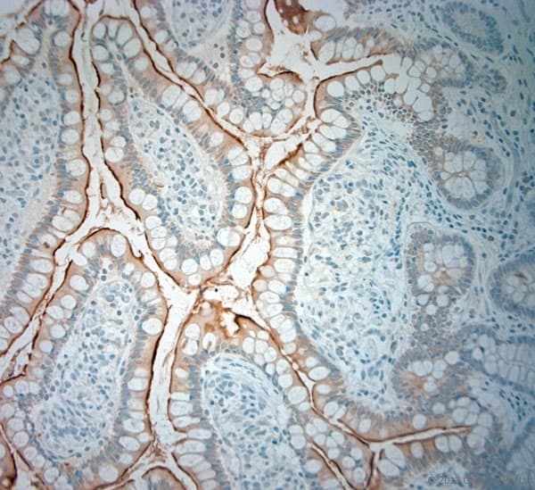 SLC5A8 / AIT Antibody (aa560-610)