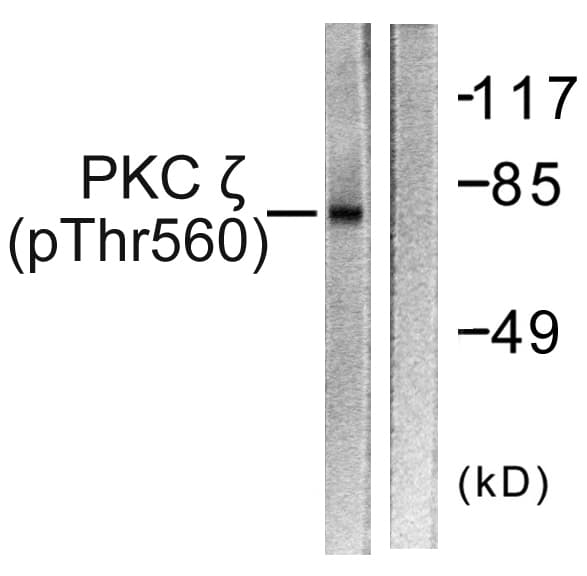 Polyclonal Rabbit anti-Human PRKCZ / PKC-Zeta Antibody (phospho-Thr560, IHC, WB)