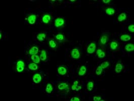 HNRNPF / hnRNP F Antibody (clone OTI5F5)