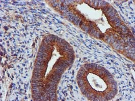 EPN2 Antibody (clone OTI1F5)
