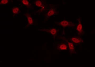 GTF2H2 Antibody