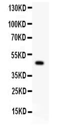 Polyclonal Rabbit anti-Human P2RX5 / P2X5 Antibody (aa333-422, IHC, WB)