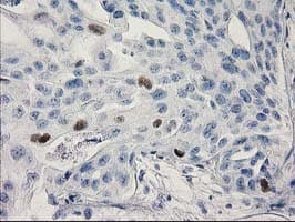 Monoclonal Mouse anti-Human TP53 / p53 Antibody (clone OTI3G9, IHC, IF, WB)