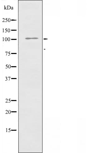 Polyclonal Rabbit anti-Human CDCA2 Antibody (IF, WB)
