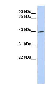 TRIB1 Antibody (aa215-264)
