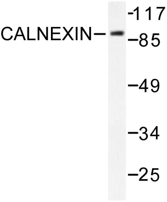 Polyclonal Rabbit anti-Human CANX / Calnexin Antibody (Asp577, IHC, IF, WB)