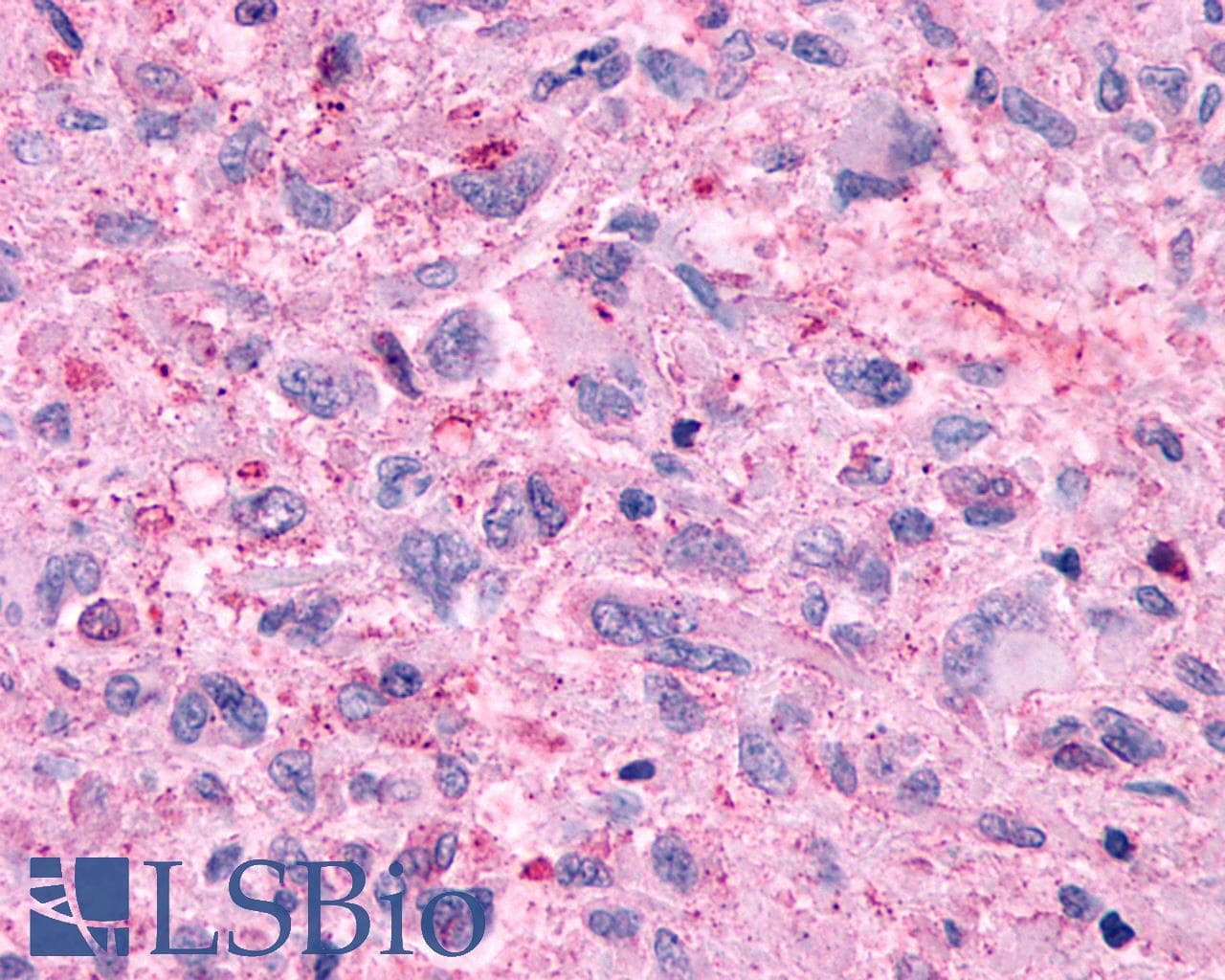 PathPlus™ GPR48 / LGR4 Antibody (N-Terminus)