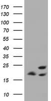 ICT1 / DS1 Antibody (clone OTI2F9)