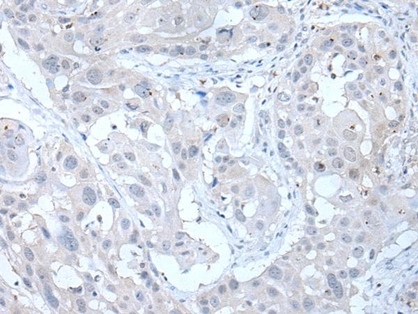 ARP5 / ANGPTL6 Antibody