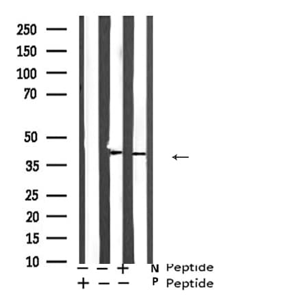 ATF4 Antibody (phospho-Ser219)