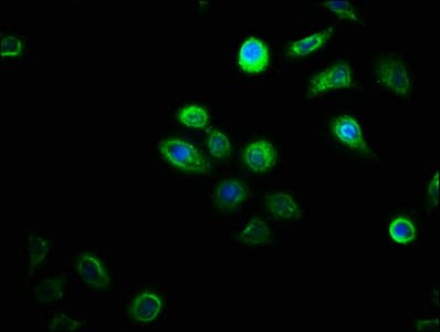 Polyclonal Rabbit anti-Human DHRSX Antibody (IHC)