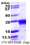 Human RAB2A / RAB2 Protein (Recombinant His)