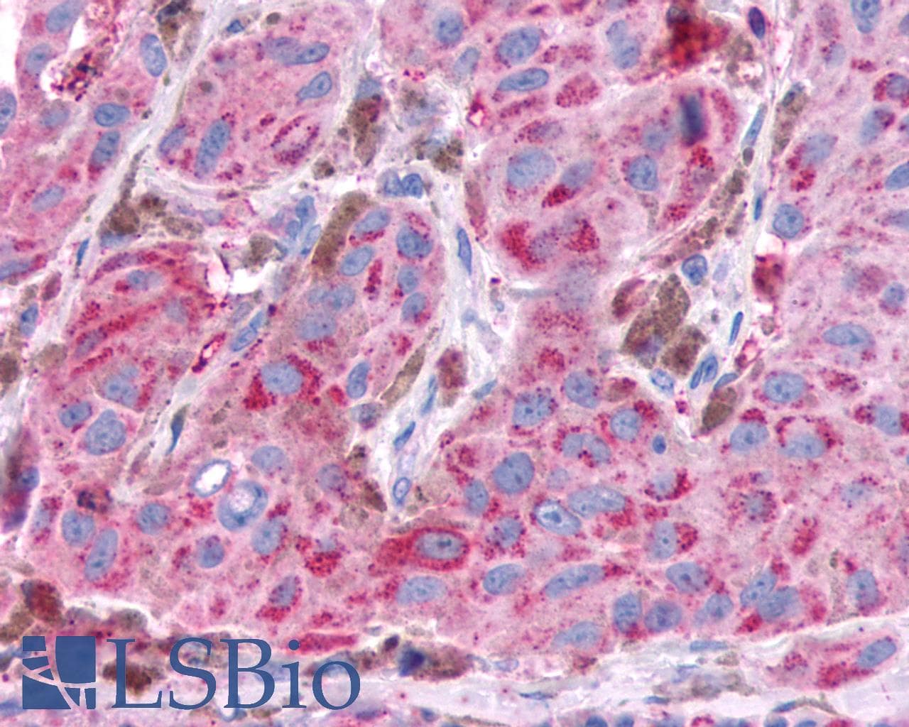 PathPlus™ NPY4R / PPYR1 Antibody (Extracellular Domain)