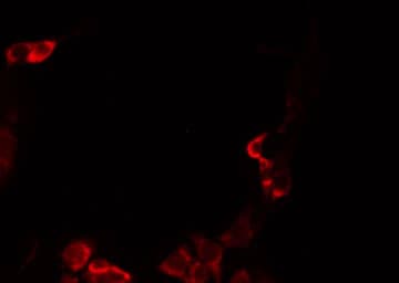 Alpha4GnT / A4GNT Antibody