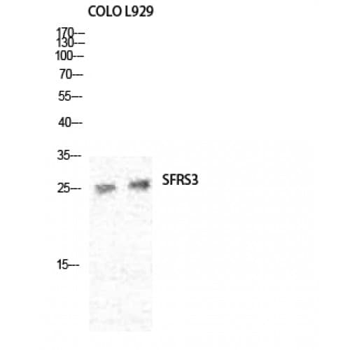 Polyclonal Rabbit anti-Human SRSF3 / SRP20 Antibody (80-160 aa, C-terminal, IHC, IF, WB)