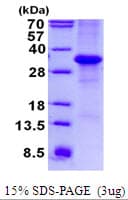 Human MFAP4 Protein (Recombinant His)