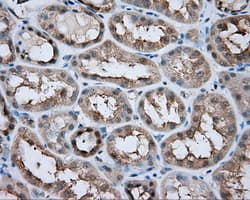 LIPG / Endothelial Lipase Antibody (clone OTI5C3)