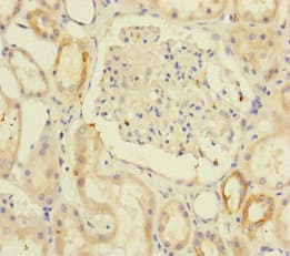 RIC8A Antibody