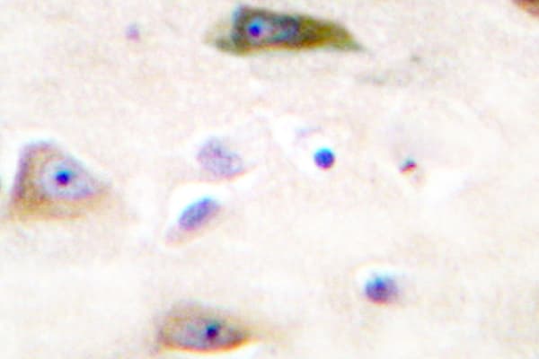 Polyclonal Rabbit anti-Human GRIA2 / GLUR2 Antibody (Tyr873, IHC, IF, WB)