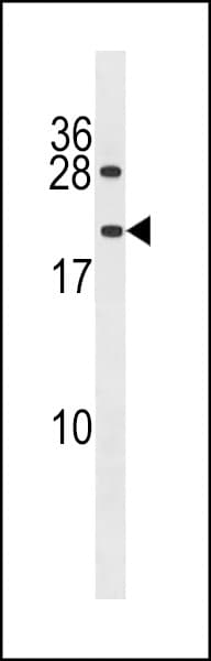 Polyclonal Rabbit anti-Human PPIAL4G Antibody (aa1-30, WB)