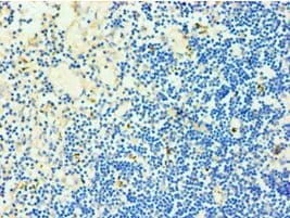 Polyclonal Rabbit anti-Human Treacle / TCOF1 Antibody (aa1189-1488, IHC)