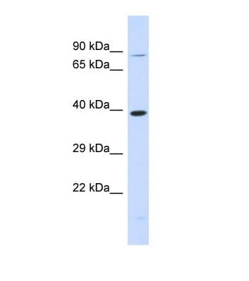 Polyclonal Rabbit anti-Human RHBDL2 / RRP2 Antibody (aa23-72, WB)