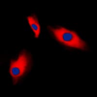 ACTG2 Antibody (N-Terminus)