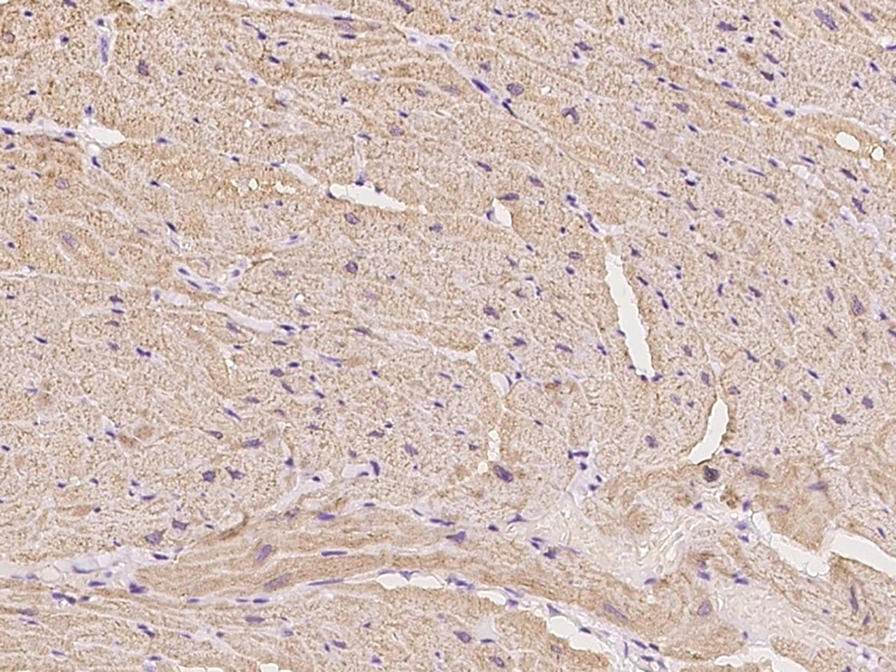 Polyclonal Rabbit anti-Human CASQ1 / Calsequestrin 1 Antibody (Preservative Free, IHC, IF)