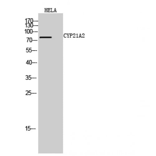 Polyclonal Rabbit anti-Human CYP21A2 Antibody (Internal, WB)