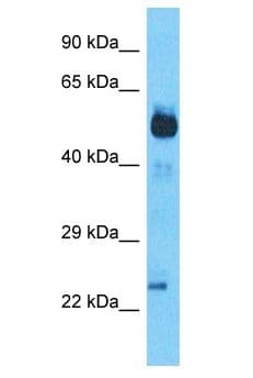 SCHIP1 Antibody (aa37-86)