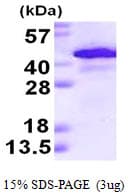 Human ADH1A / Alcohol Dehydrogenase Protein (Recombinant His)