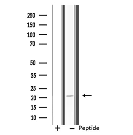 Polyclonal Rabbit anti-Human RPL11 / Ribosomal Protein L11 Antibody (IF, WB)