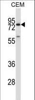 Polyclonal Rabbit anti-Human MMP16 Antibody (aa519-548, IHC, WB)