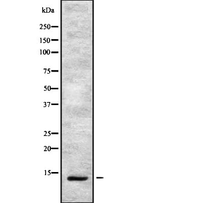 LGALS1 / Galectin 1 Antibody