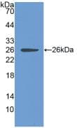 CLIC1 / NCC27 Antibody (aa79-241, PE)