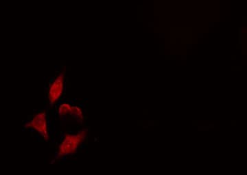 NEIL1 Antibody