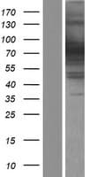EXOC7 Protein (Over-Expression Lysate Myc-DDK (Flag))