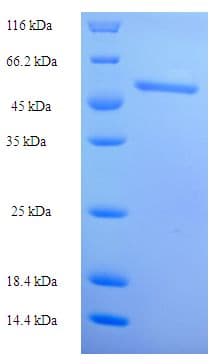Human RDH12 / LCA3 Protein (Recombinant His-SUMO)
