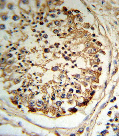 PLAT / TPA Antibody (aa371-399)