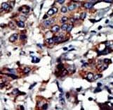 PACSIN3 Antibody (aa1-30)