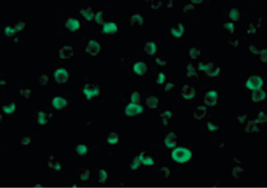 CFLAR / FLIP Antibody
