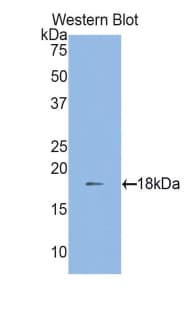 TNFSF13 / APRIL Antibody (aa96-240)