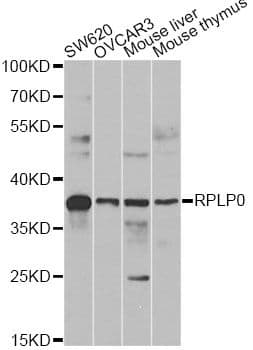 RPLP0 Antibody