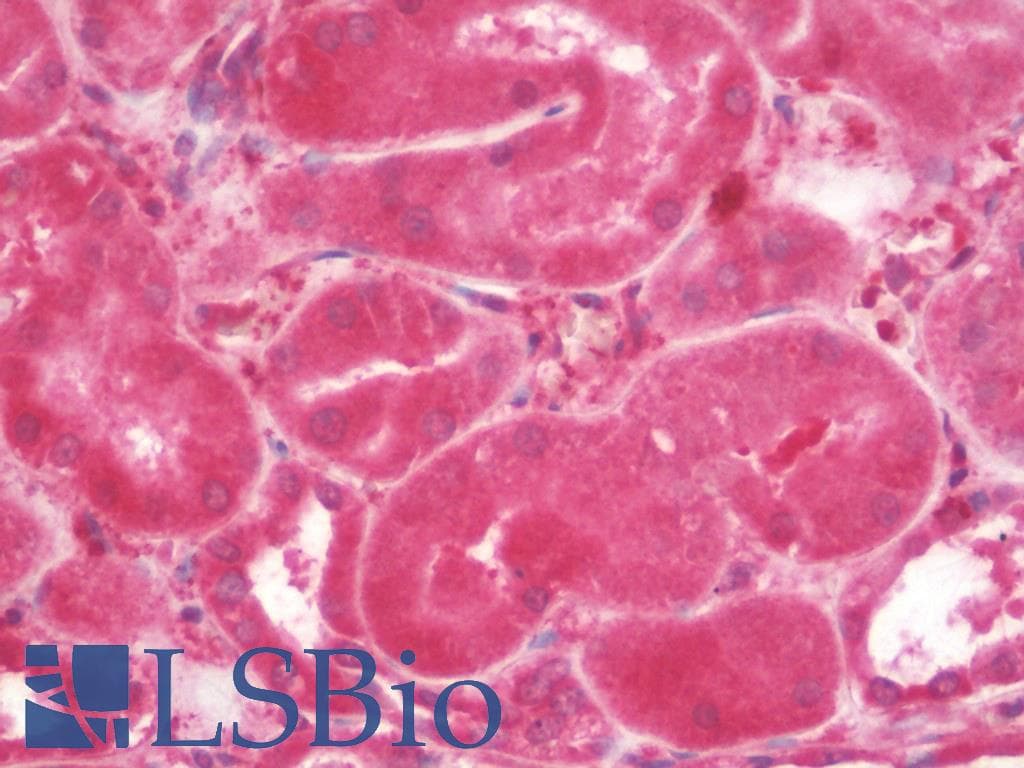 IHC-plus™ MAP1LC3A / LC3A Antibody