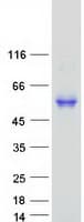 Human ESAM Protein (Recombinant Myc-DDK (Flag))