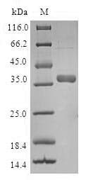 Human TIMM8A Protein (Recombinant GST, N-terminus)
